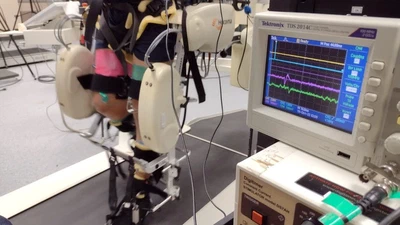 Robot-Assisted Locomotor Training after Spinal Cord Injury featured image