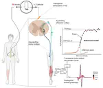 Optimal sigmoid function models for analysis of transspinal evoked potential recruitment curves recorded from different muscles