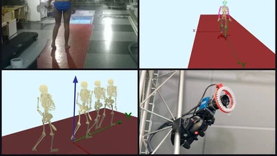 Three-dimensional kinematic gait analysis in patients with spastic diplegia featured image