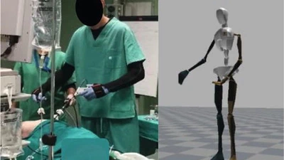 Advanced Ergonomics in Laparoscopic Surgery featured image